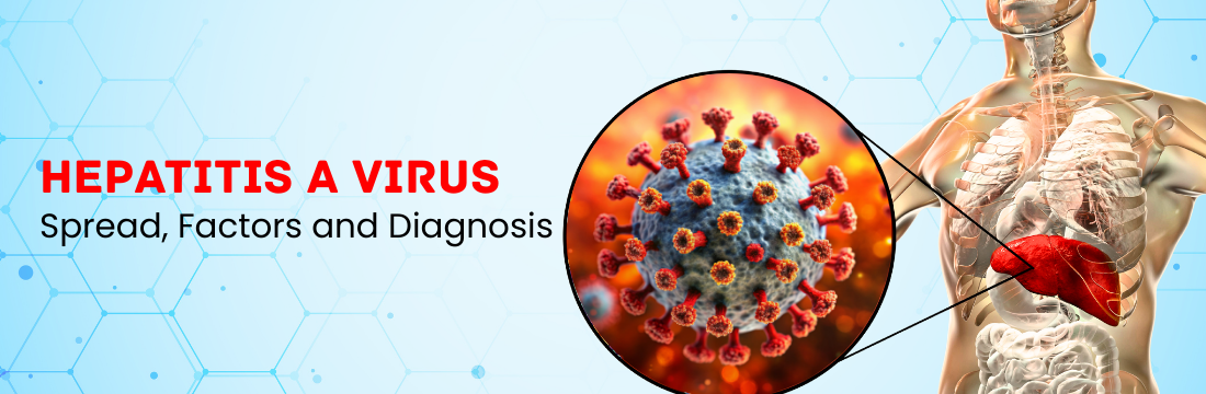 Hepatitis A Virus: Spread, Factors and Diagnosis